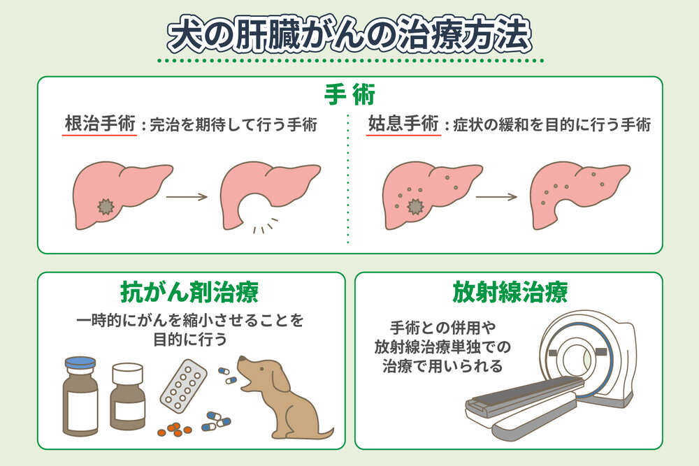 肝臓がんの治療